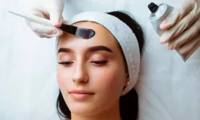 Carbon laser facial
